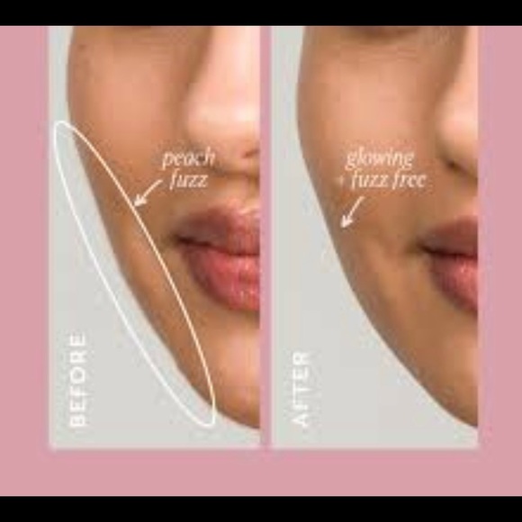 DERMAFLASH Complete Exfoliation Kit - Picture 3 of 14